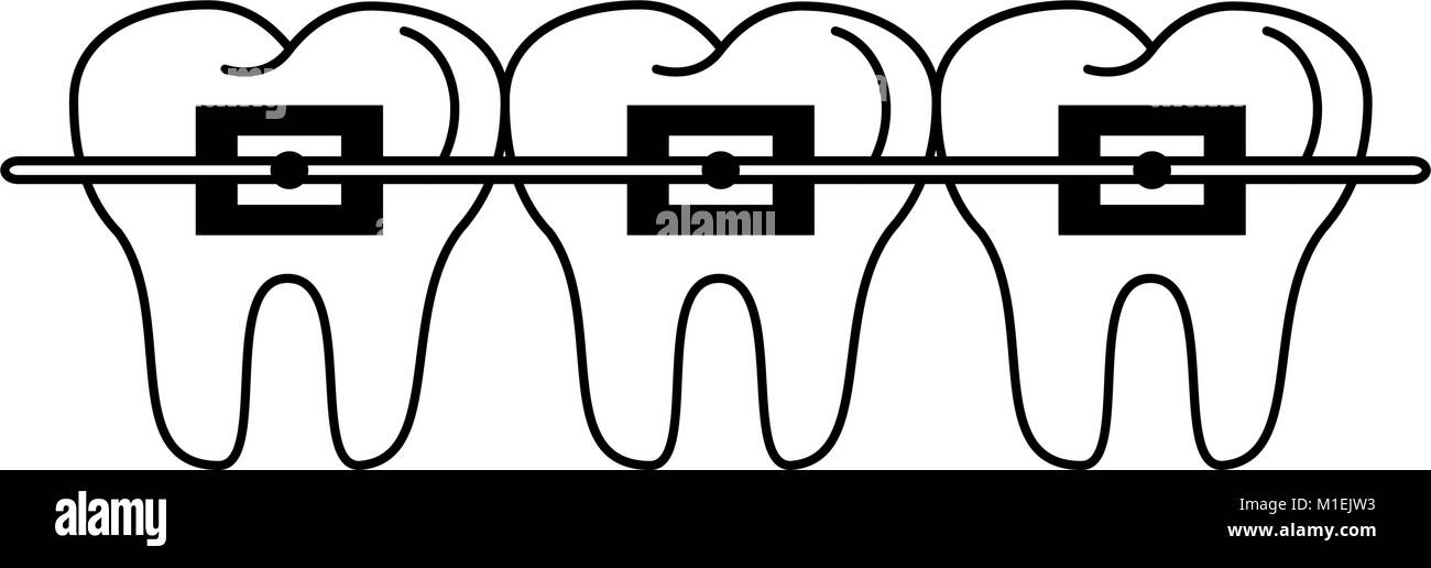 Orthodontic brackets Stock Vector Images Alamy