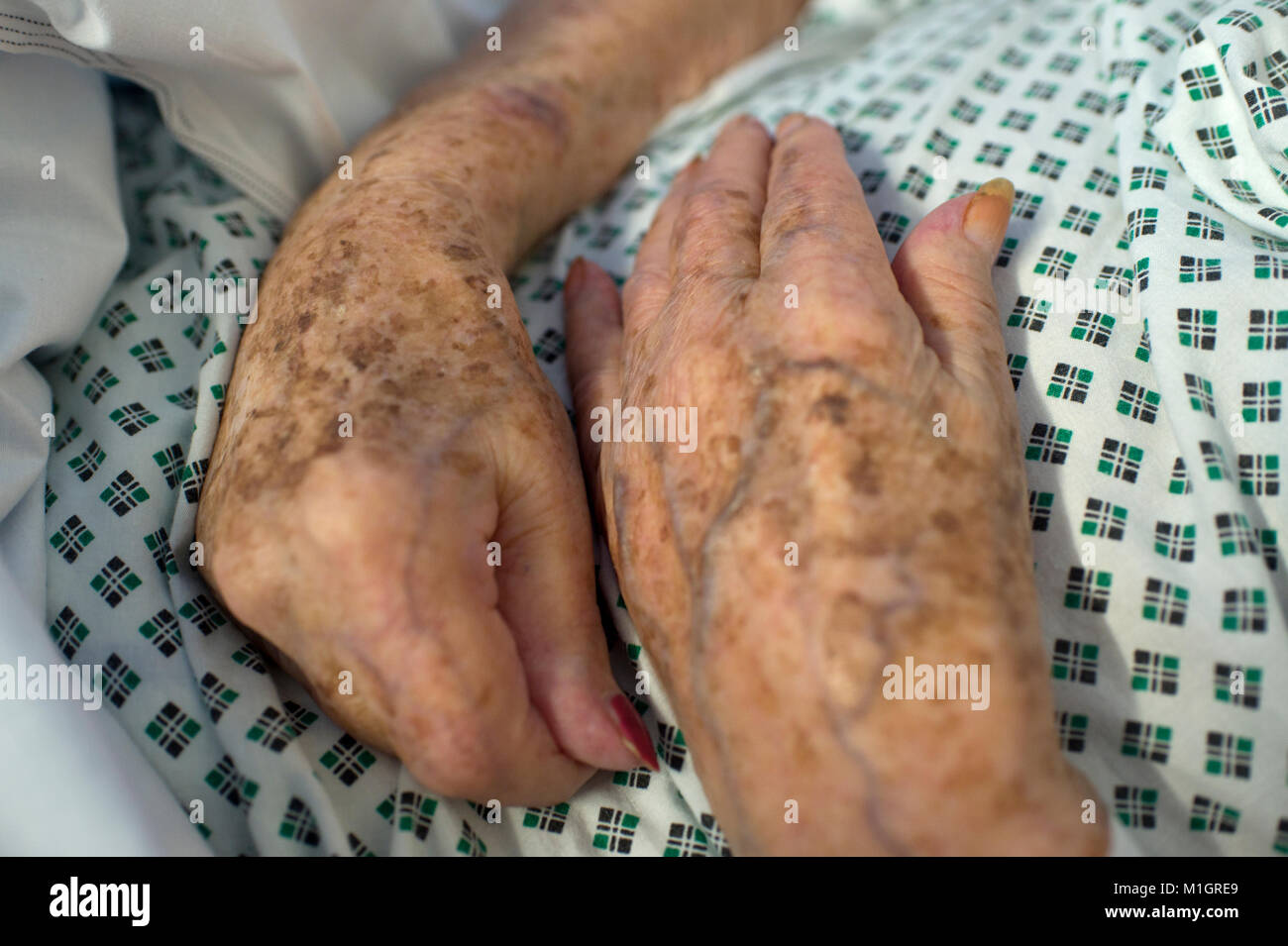 Liver Spots Hands High Resolution Stock Photography And Images Alamy