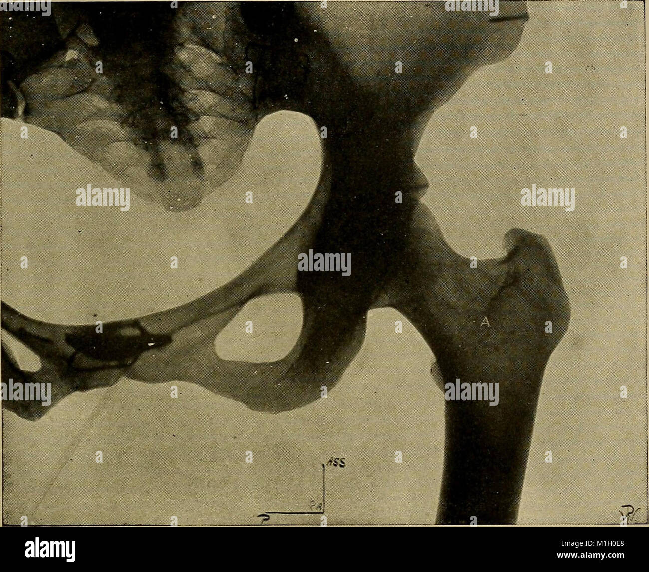 Normal Rug X Ray This instructional system provides a detailed guide on X-ray methods ...