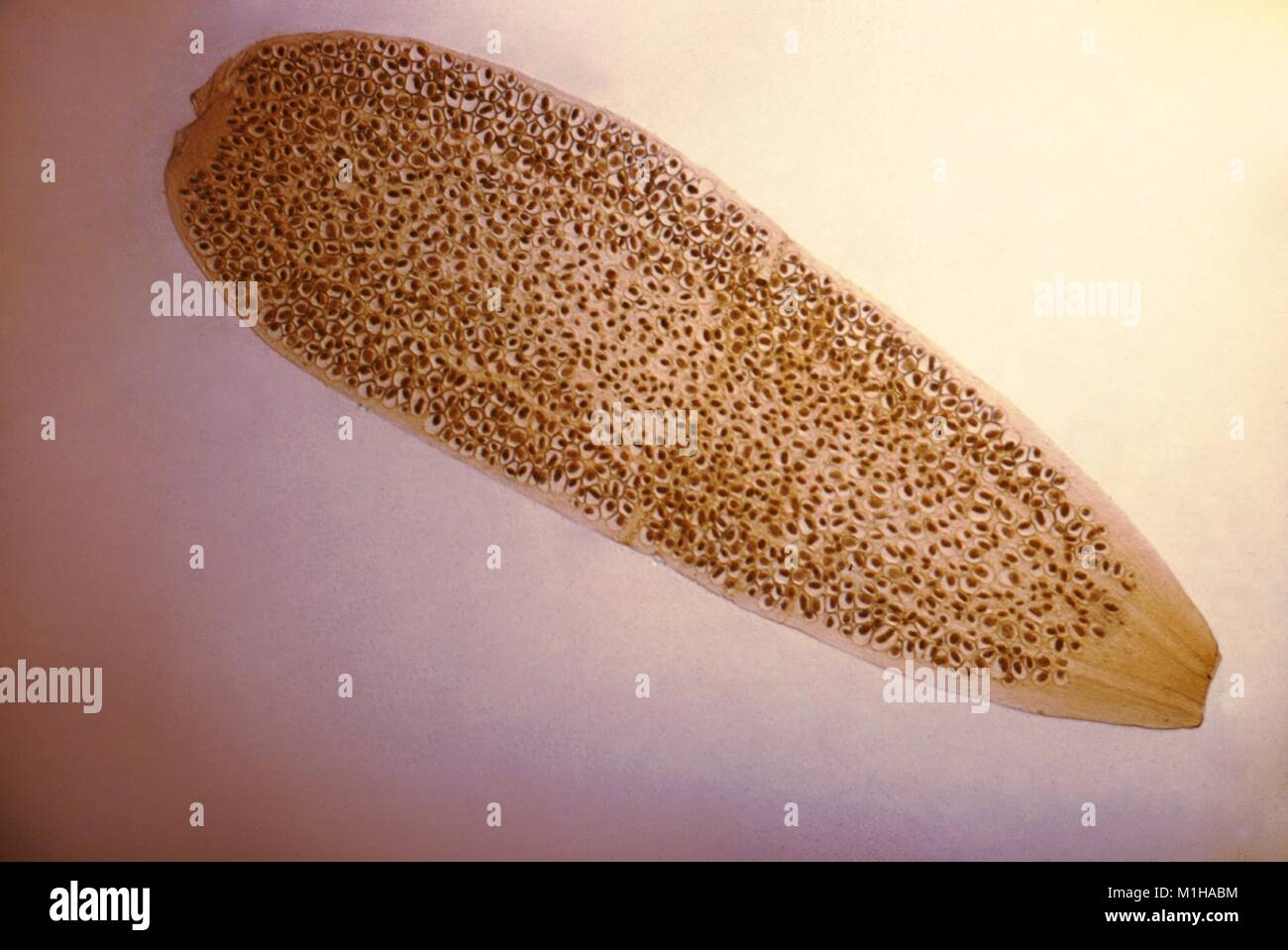 Photomicrograph of a proglottid (tapeworm segment) from the flea tapeworm (Dipylidium caninum), resembling a rice grain, 1979. Image courtesy CDC. () Stock Photo