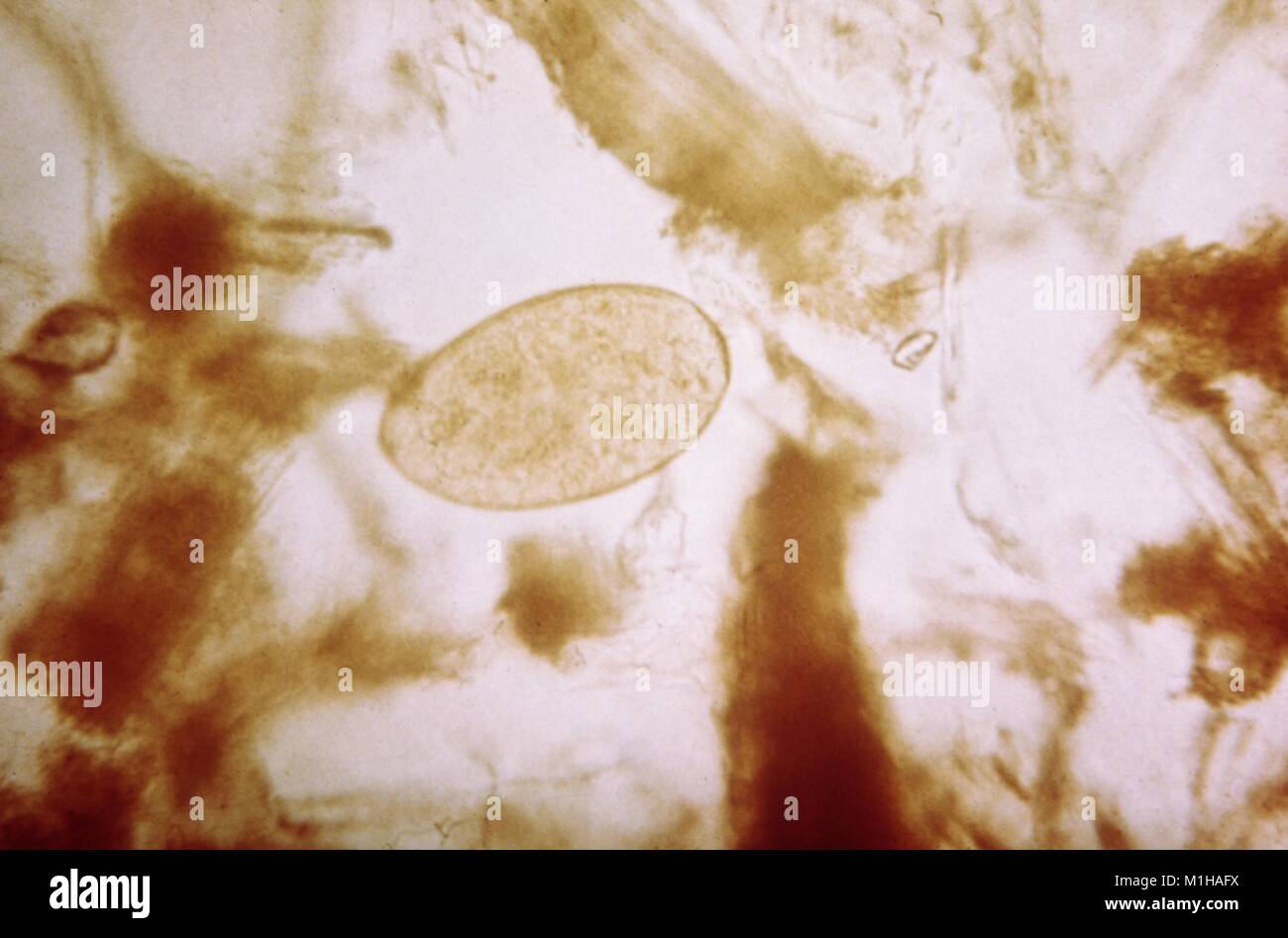 Photomicrograph of a sheep liver fluke (Fasciola hepatica) egg, a parasitic trematode that causes the disease Fascioliasis, 1979. Image courtesy CDC. () Stock Photo