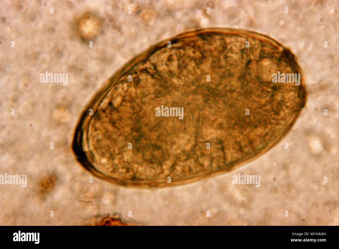 Photomicrograph of an egg from the trematode parasite Paragonimus westermani or the Japanese lung fluke, the major trematode species that causes the disease Paragonimiasis, 1979. Image courtesy CDC. () Stock Photo