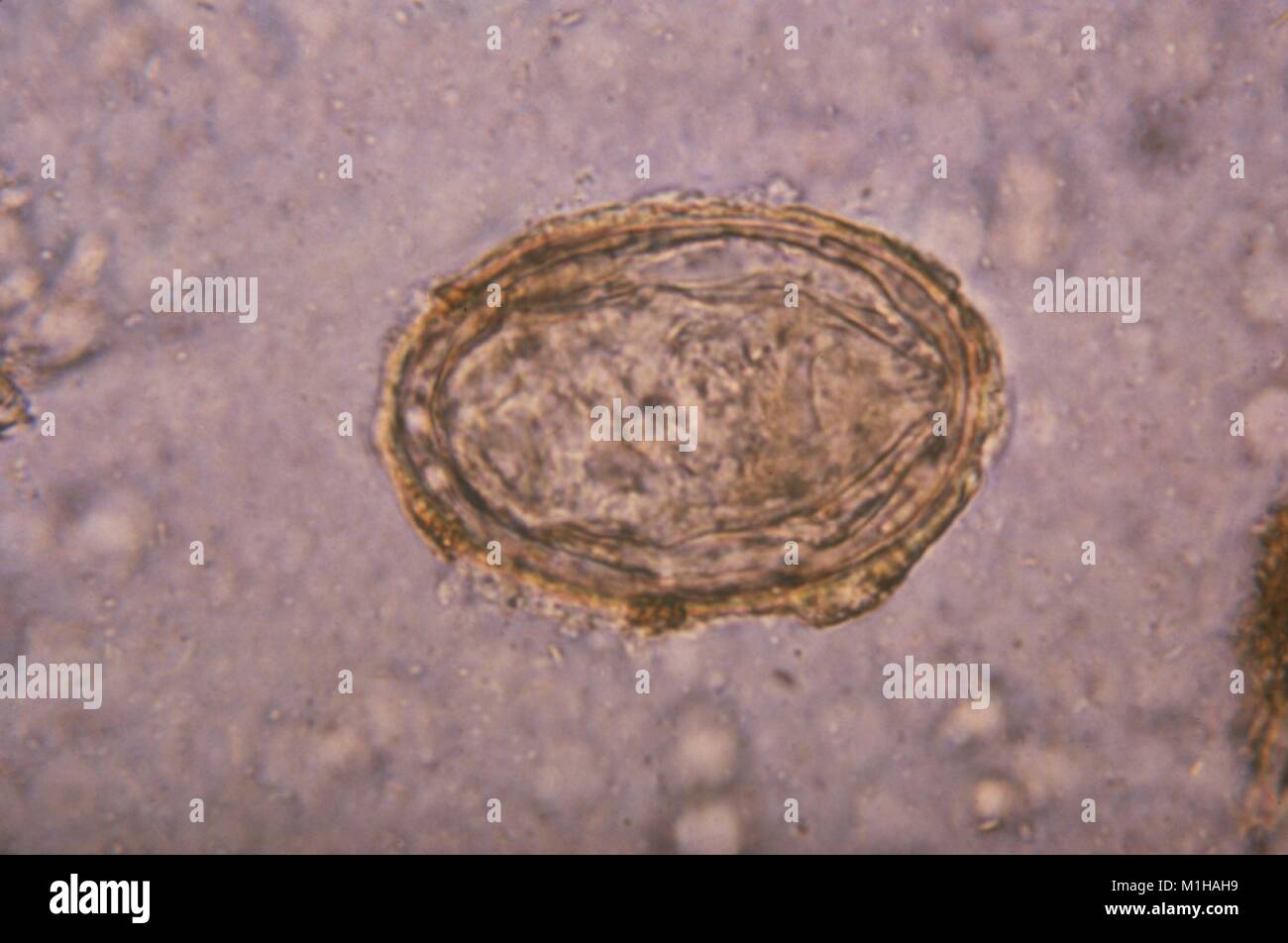 Photomicrograph of an egg from the trematode Schistosoma japonicum, one of the blood flukes that cause the parasitic disease Schistosomiasis, 1979. Image courtesy CDC. () Stock Photo