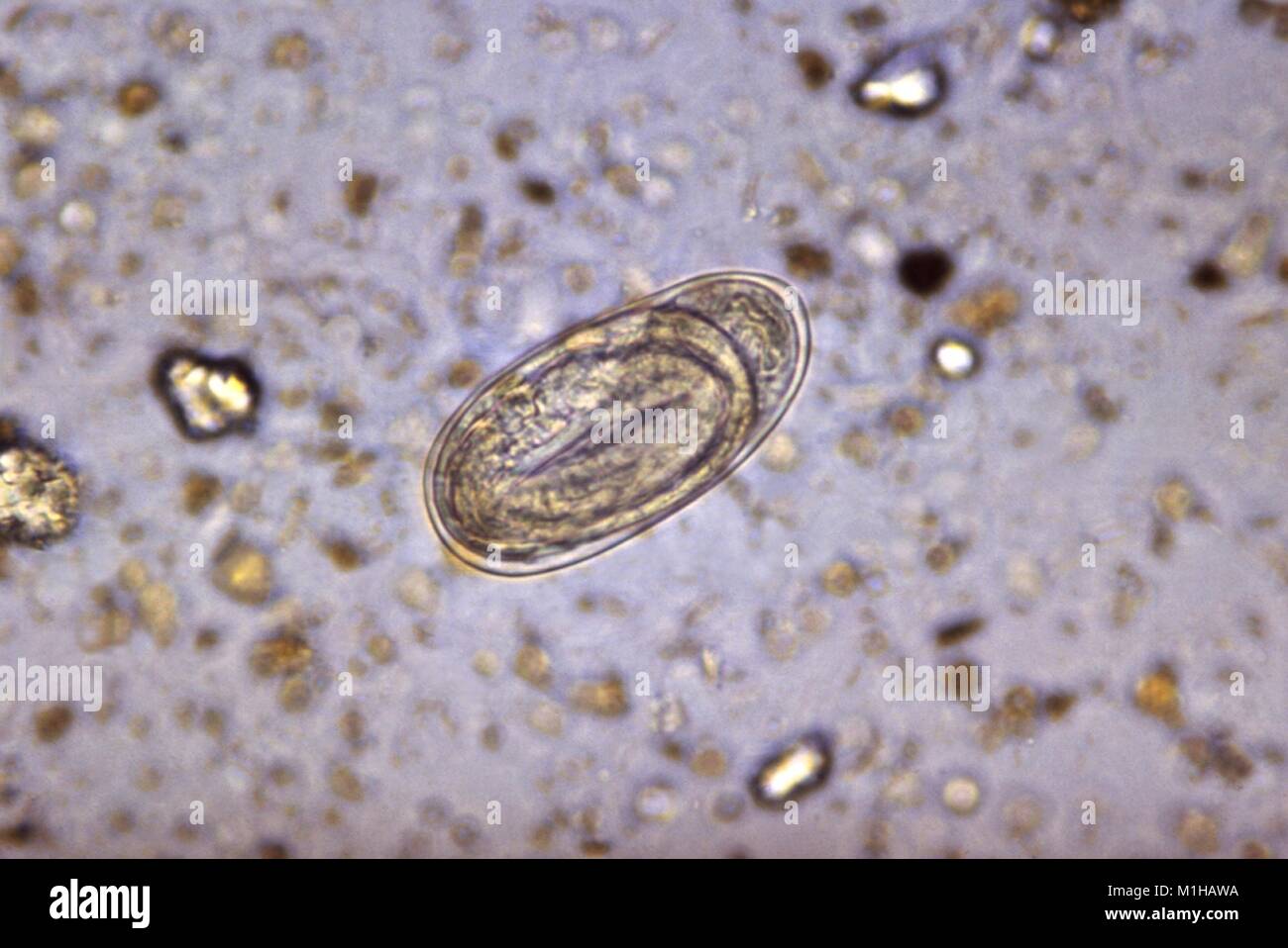 Photomicrograph of an embryonated hookworm egg  