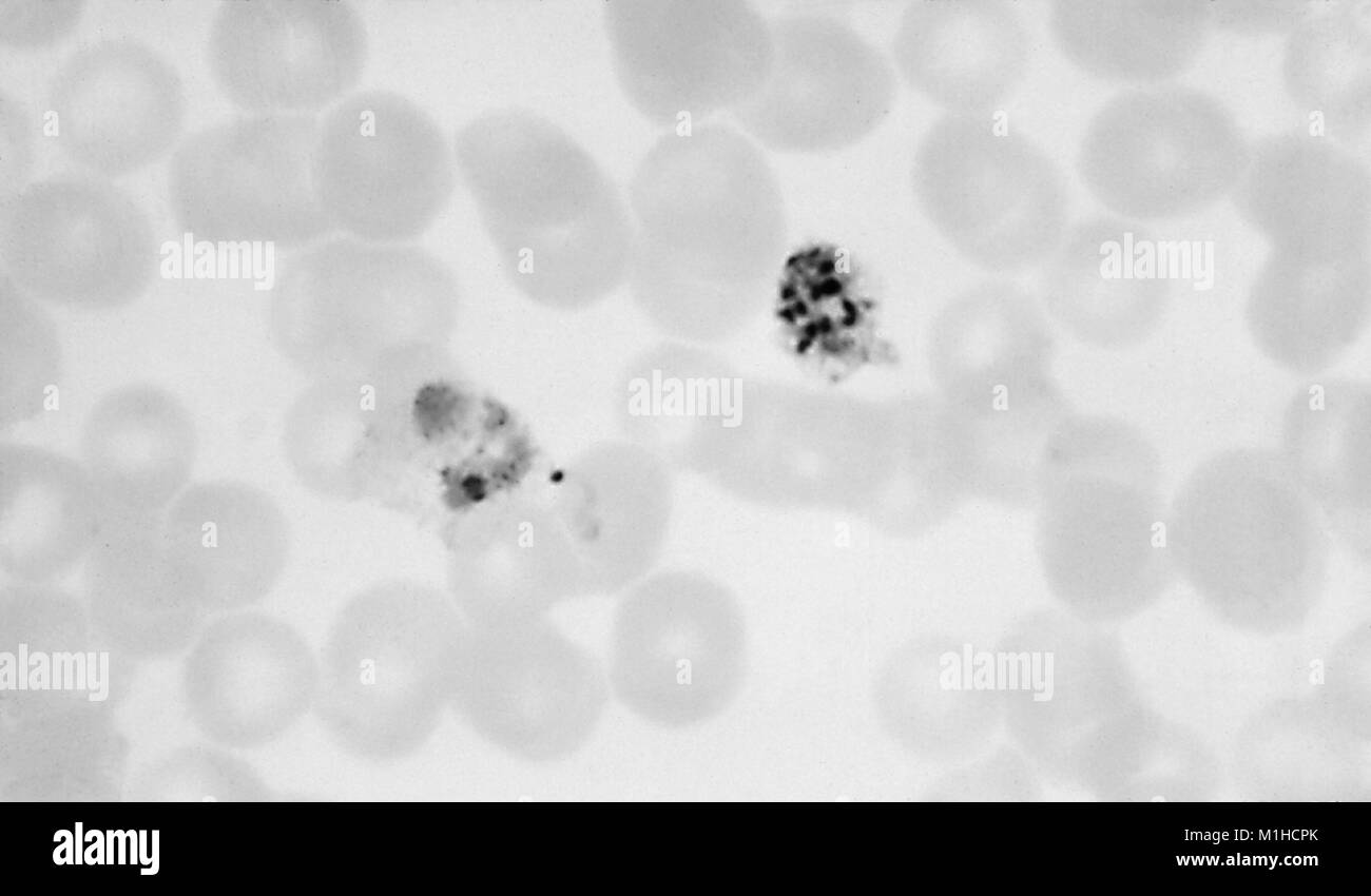 Photomicrograph of the malaria causing parasite Plasmodium vivax in immature schizont and old trophozoite forms, on a thin film blood smear magnified 1125 x, 1966. Image courtesy CDC/Dr. Mae Melvin. () Stock Photo