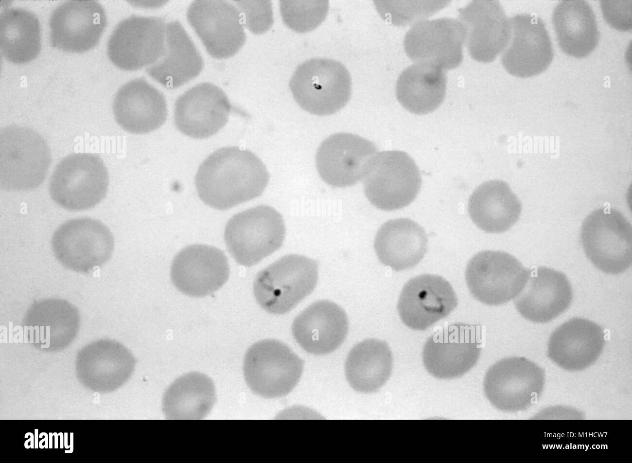Photomicrograph of the malaria causing parasite Plasmodium vivax, in a ring and growing ameboid trophozite forms, on a thin film blood smear, 1965. Image courtesy CDC/Dr. Mae Melvin. () Stock Photo
