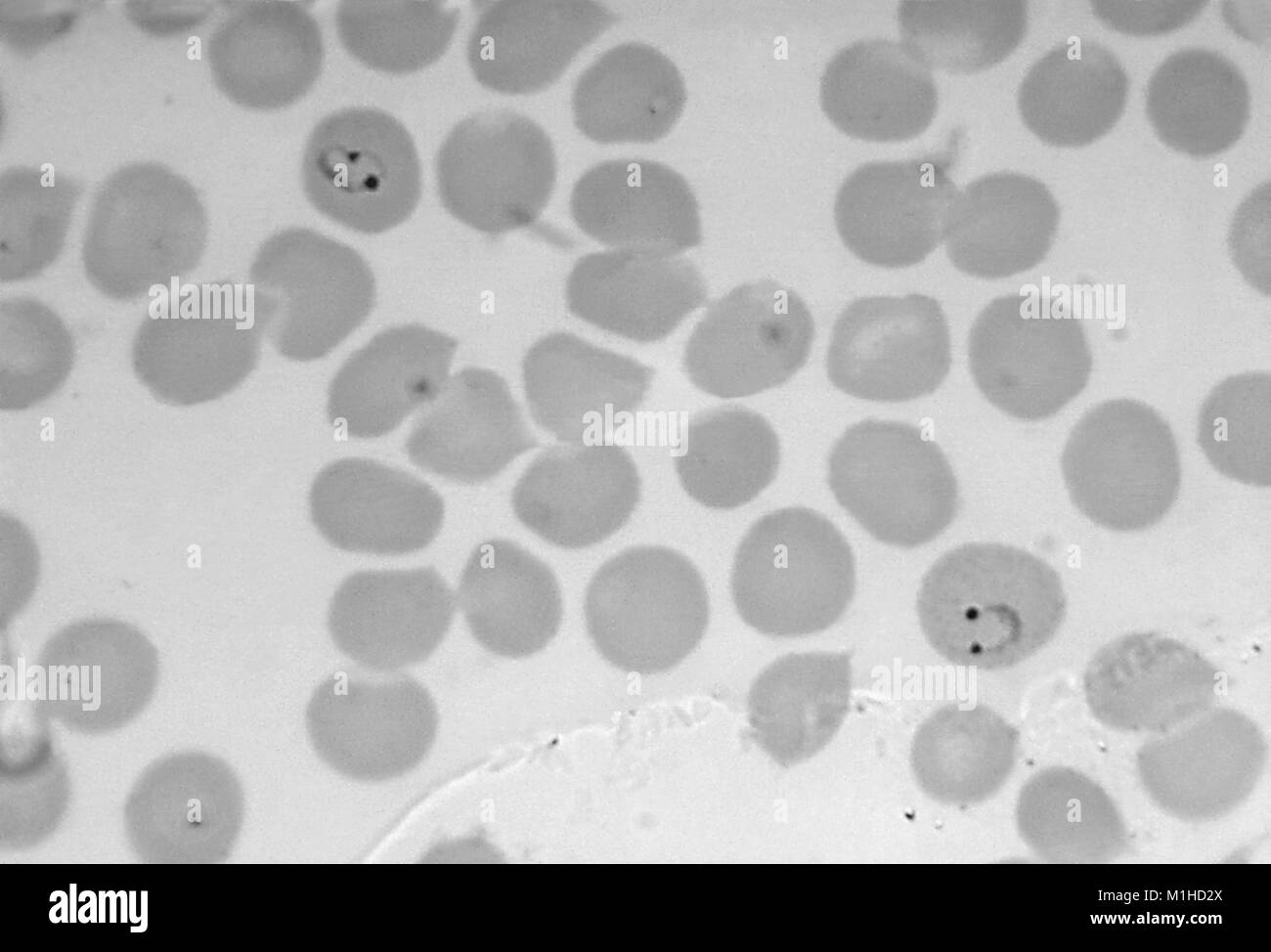 Photomicrograph of the malaria parasite Plasmodium vivax in ring form with 2 chromatin dots, on thin film, magnified 1125 x, 1965. Image courtesy CDC/Dr. Mae Melvin. () Stock Photo