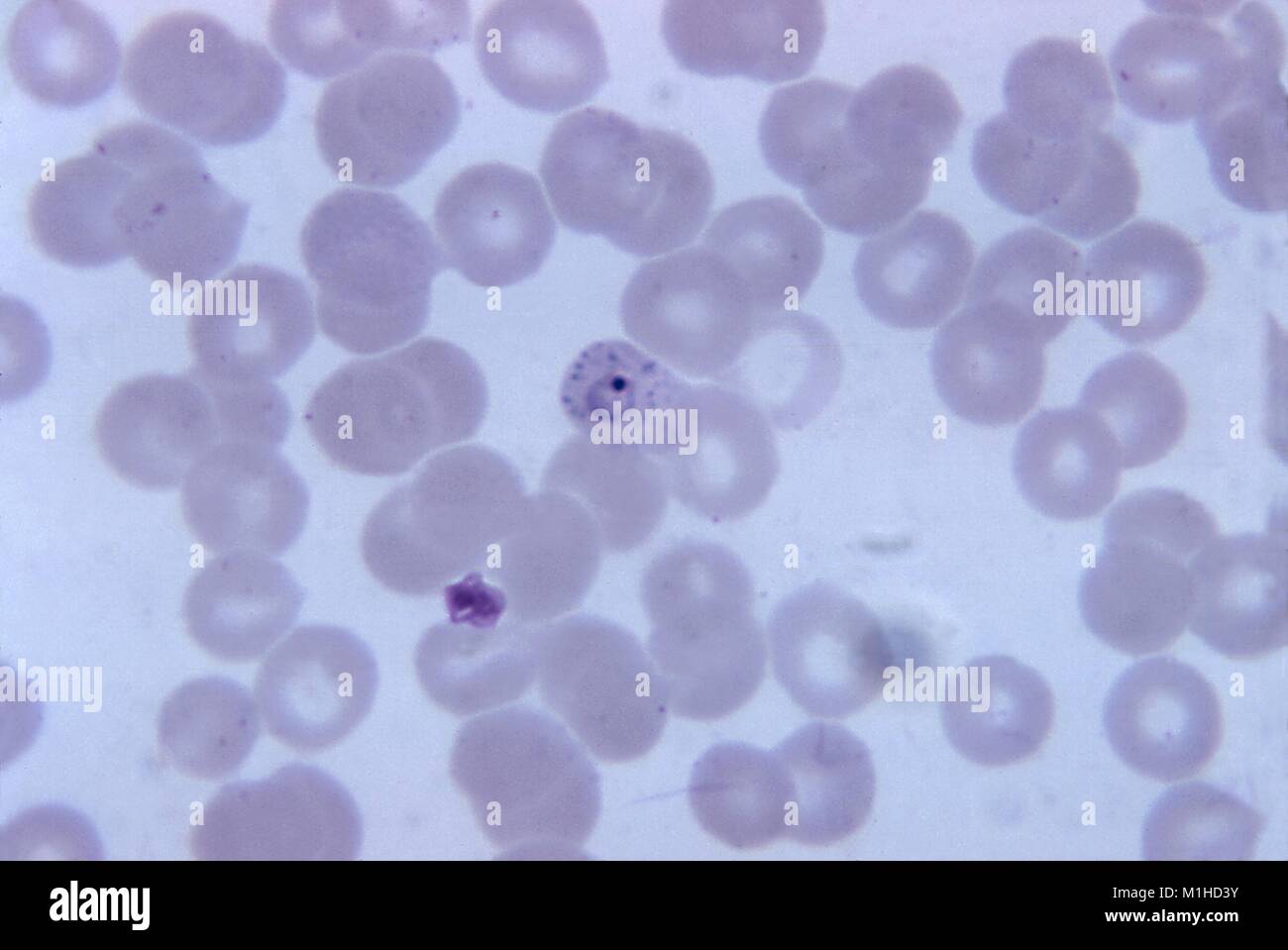 Plasmodium Vivax Inside Red Blood Cell In The Stage Of Ringform Trophozoite  Stock Photo - Download Image Now - iStock