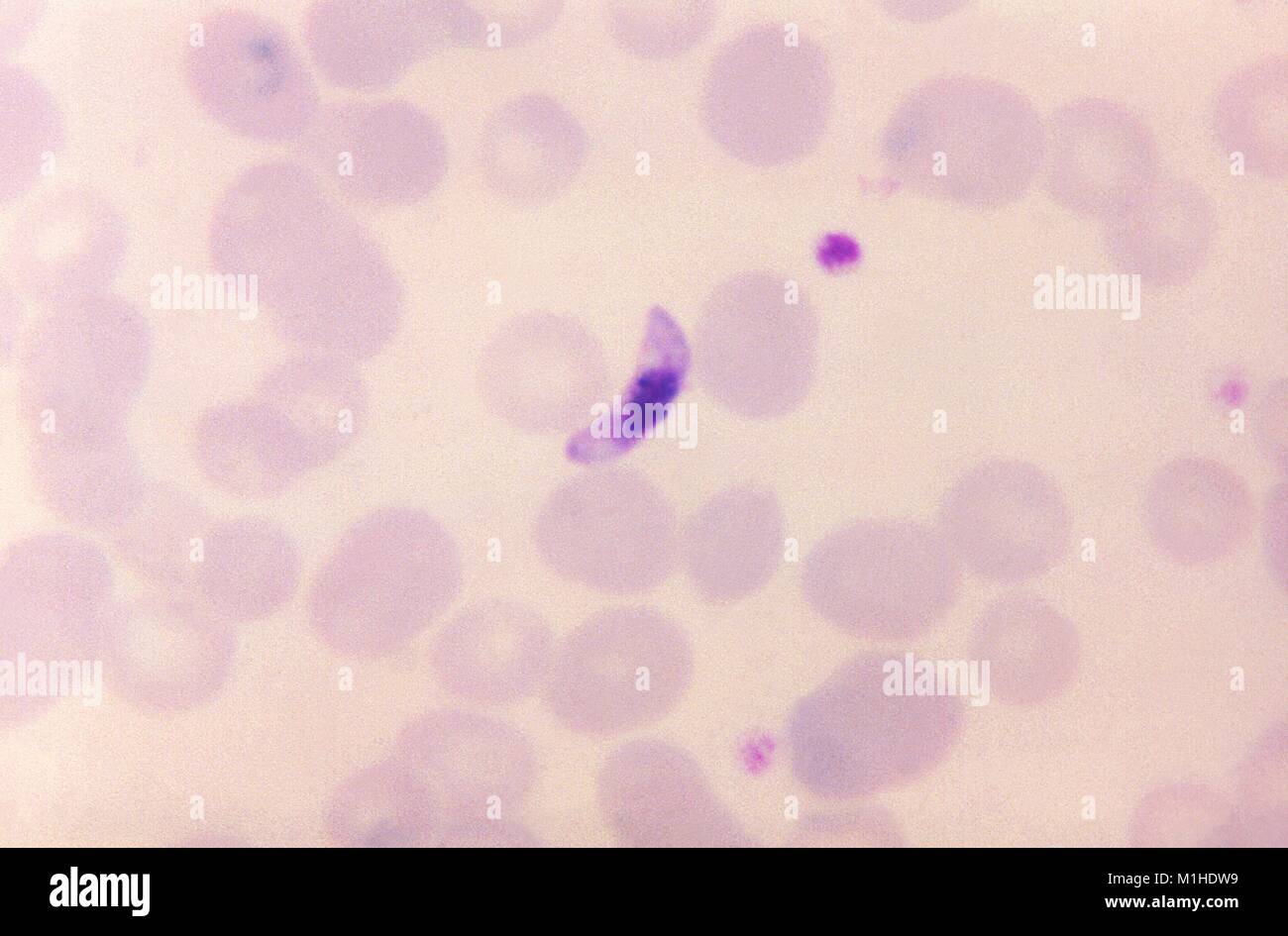 Photomicrograph of a blood smear containing a macrogametocyte of Plasmodium falciparum, the parasite ingested by Anopheles mosquitoes, causing malaria, 1966. Image courtesy CDC/Dr. Mae Melvin. () Stock Photo