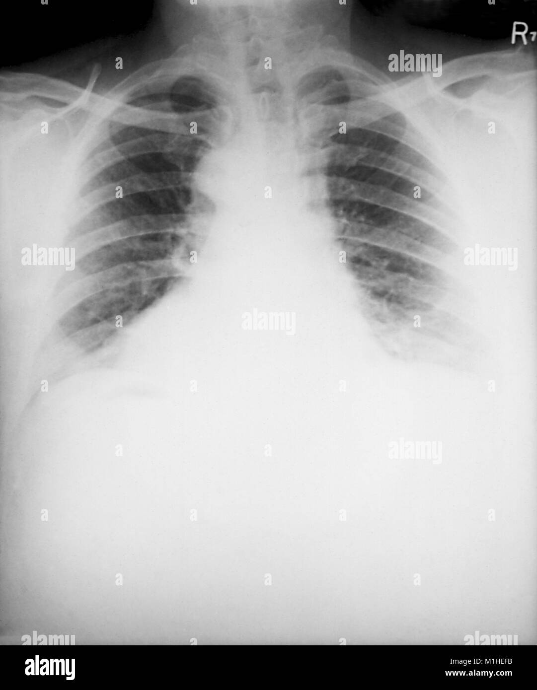 X Ray Id Cards