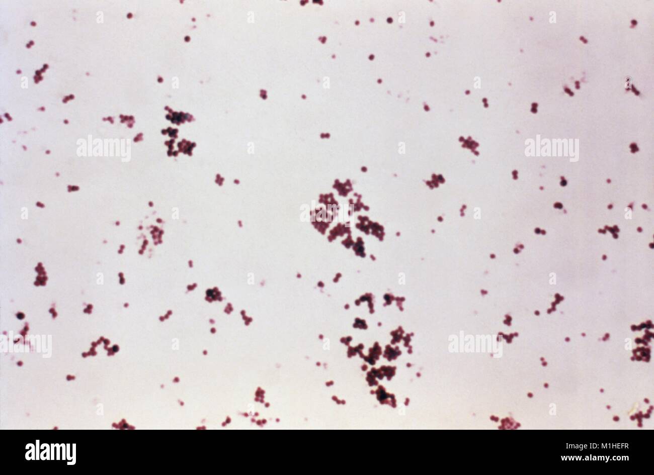 Staphylococcus aureus light microscopy. Morphology of Staphylococcus aureus  under the microscope. Micrograph of S.aureus, Gram stain. Gram-stained  smear from culture.