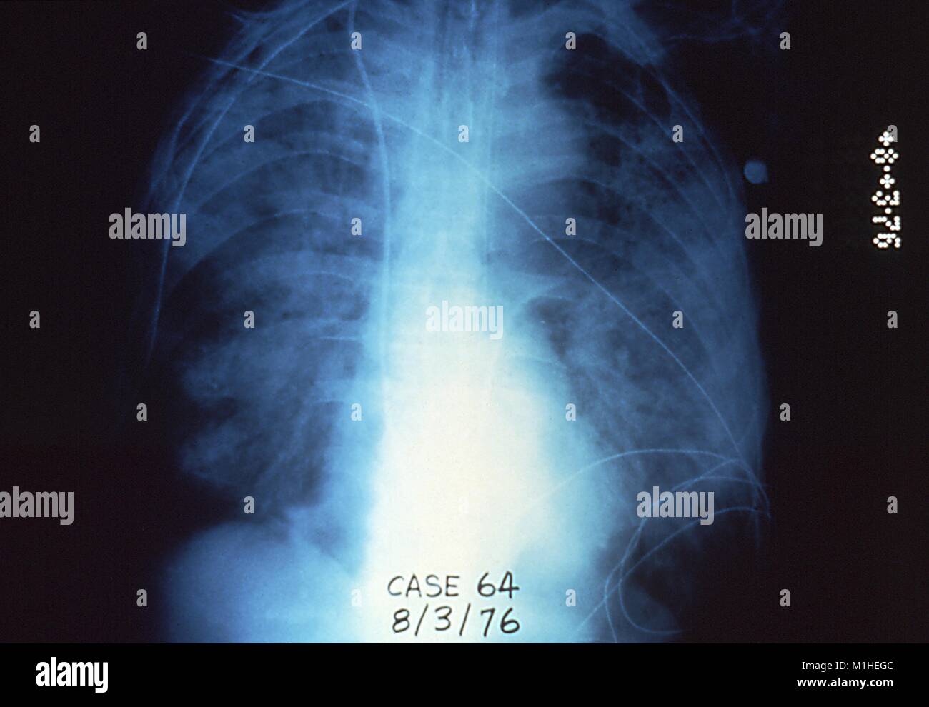 Legionella pneumophila hires stock photography and images Alamy
