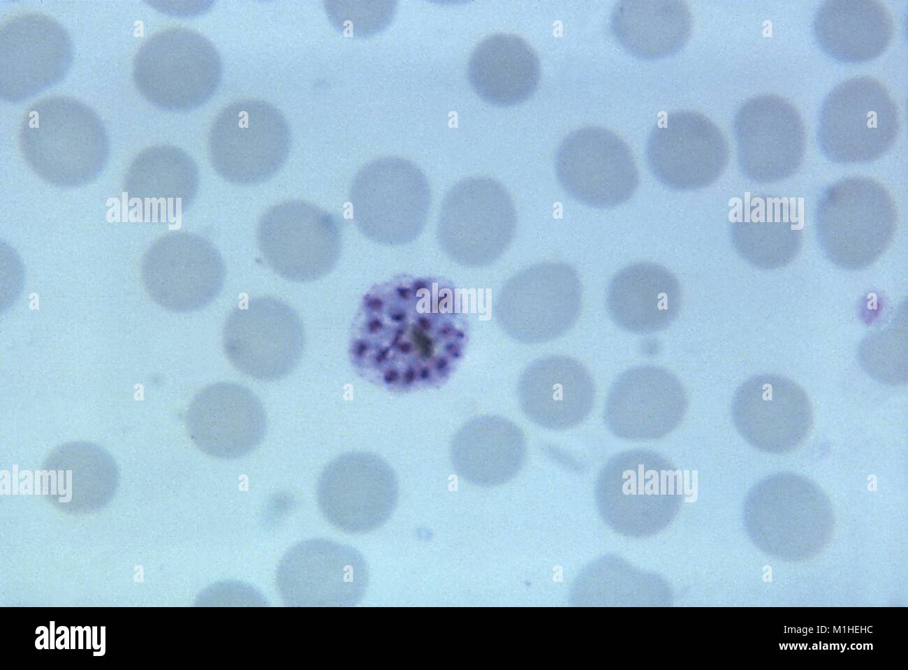 Photomicrograph of the malaria parasite Plasmodium vivax in its mature schizont phase with 18 merozoites, on thin blood smear magnified 1125 x, 1965. () Stock Photo