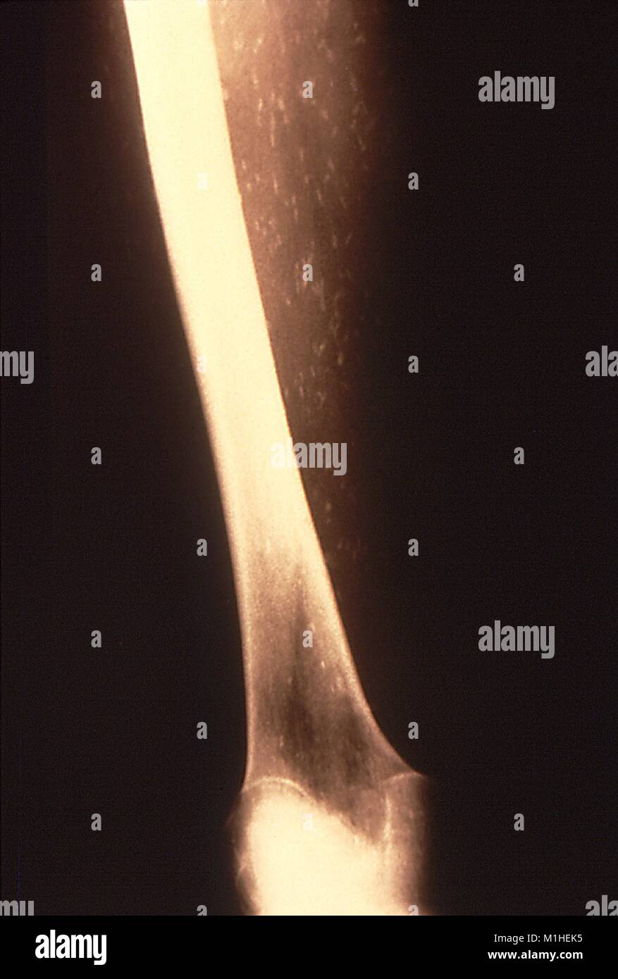 Beef tapeworm taenia saginata hires stock photography and images Alamy