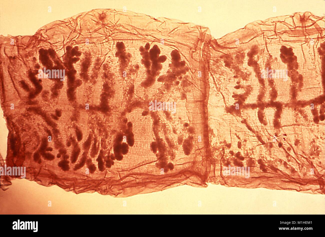 Tapeworm proglottids (Taenia solium) organ morphology revealed in the micrograph film, 1986. Image courtesy Centers for Disease Control (CDC). () Stock Photo