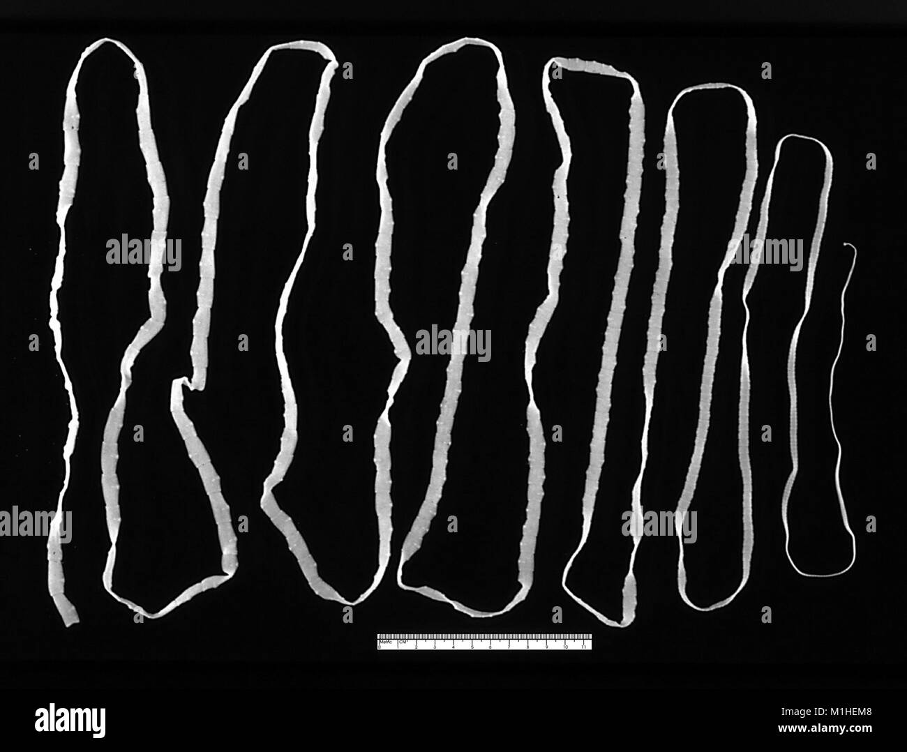 Adult tapeworm (Taenia saginata) in the human intestine, 1986. Image courtesy Centers for Disease Control (CDC). () Stock Photo