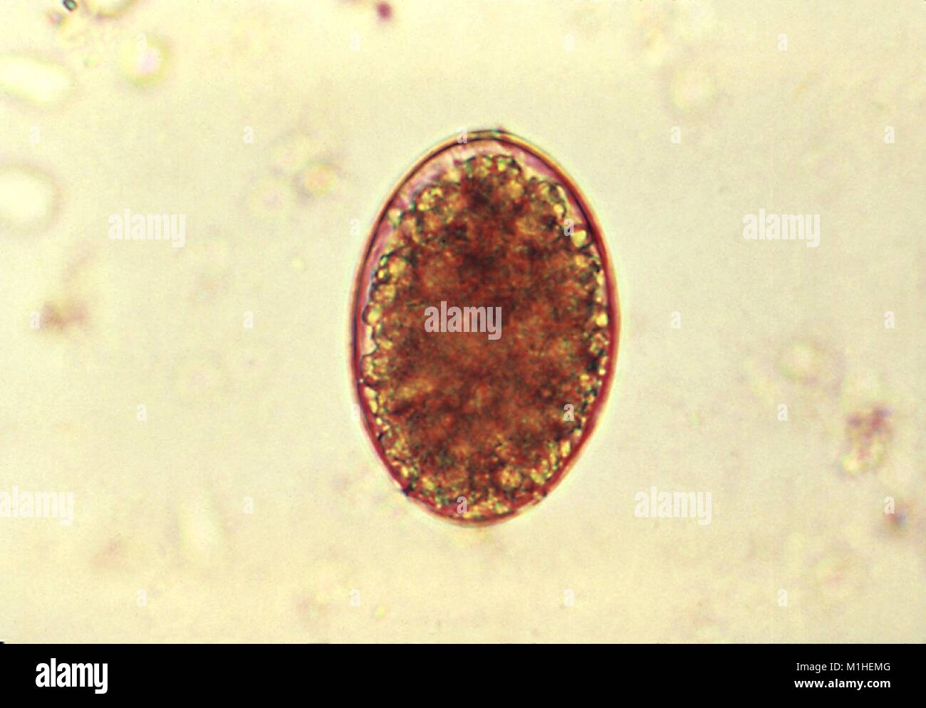 Tapeworm cestode parasite egg (Diphyllobothrium latum) revealed in the micrograph film, 1986. Image courtesy Centers for Disease Control (CDC). () Stock Photo