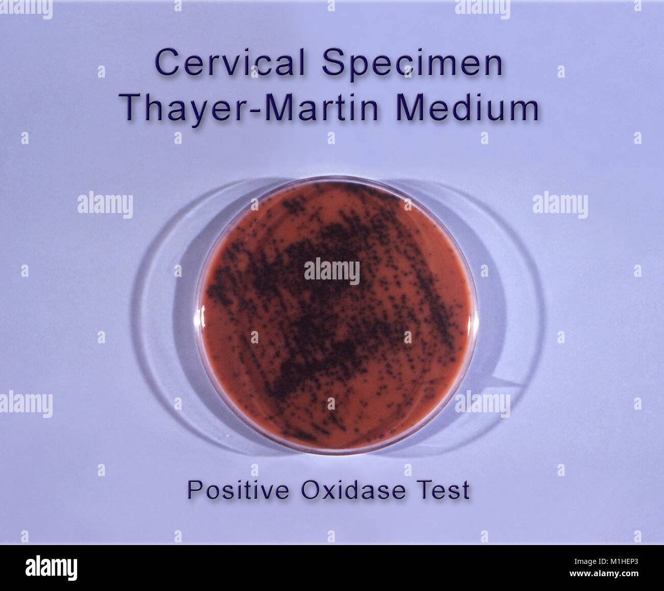 Cervical specimen hires stock photography and images Alamy