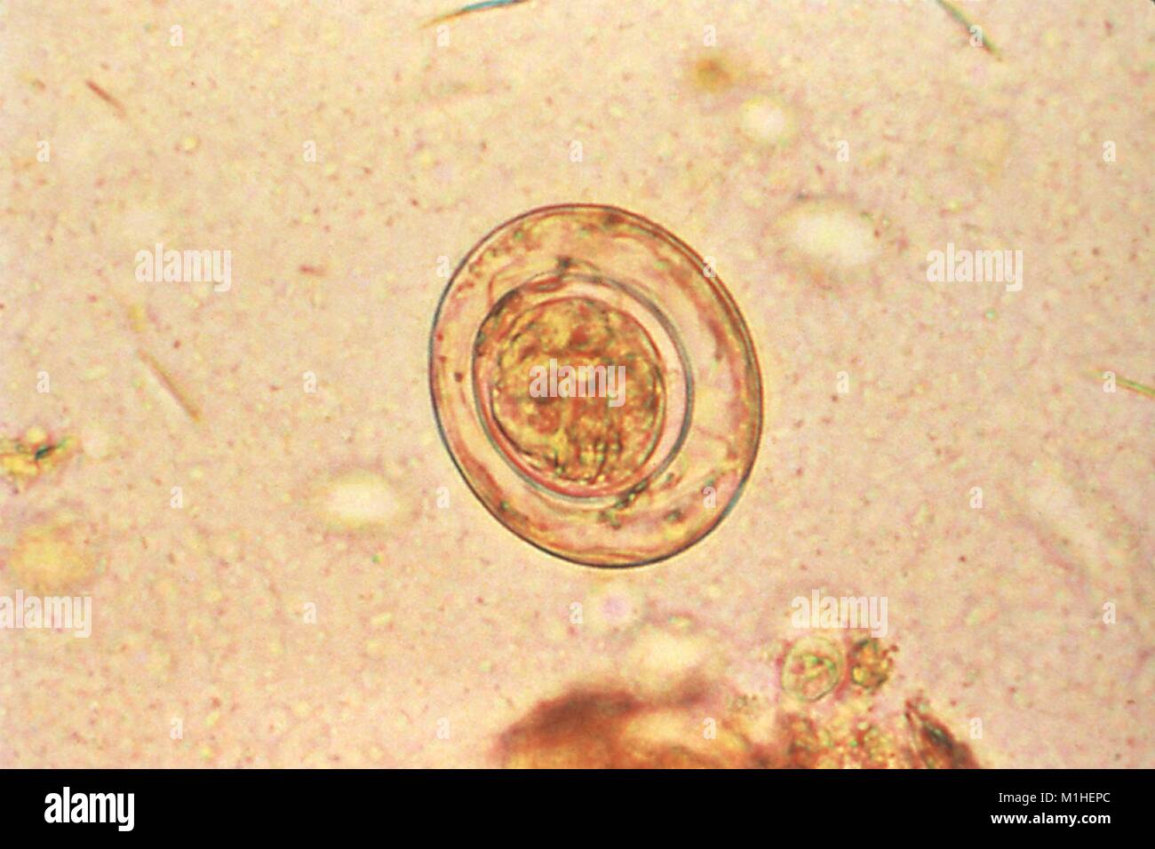 Dwarf tapeworm (Hymenolepis nana) egg revealed in the micrograph film, 1978. Image courtesy Centers for Disease Control (CDC) / Dr Moore. () Stock Photo