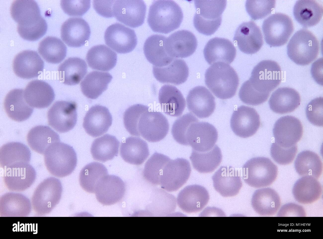 Photomicrograph of the malaria parasite Plasmodium malariae present in red blood cells in ring form, on a Giemsa stained thin blood smear, magnified 1125 x, 1971. () Stock Photo