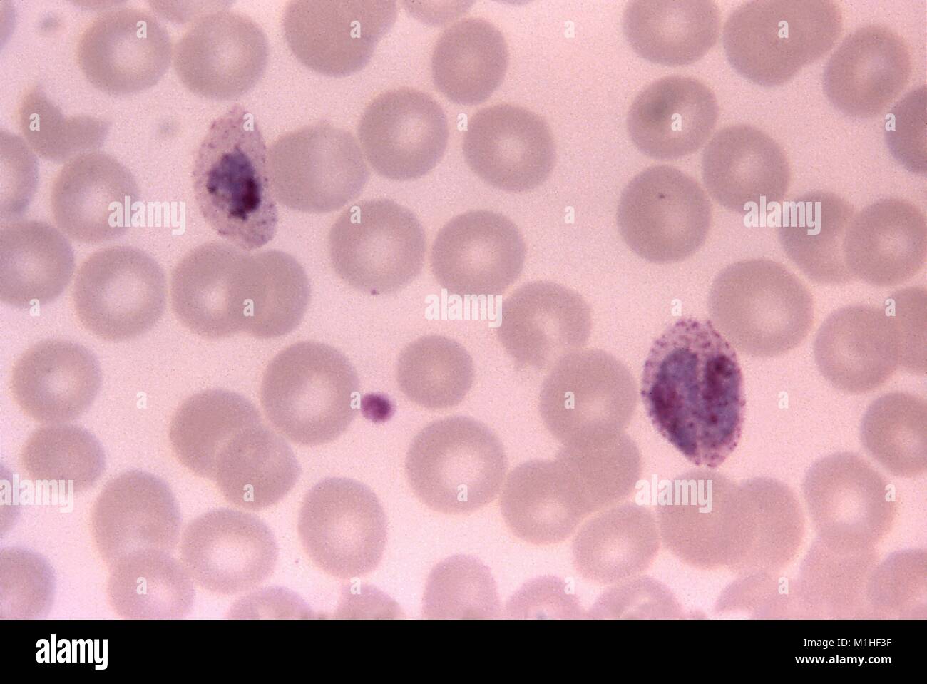 Photomicrograph of the malaria parasite Plasmodium Ovale growing as a double trophozoite in one red blood cell and a single trophozoite, on a thin film blood smear, 1966. Image courtesy CDC/Dr. Mae Melvin. () Stock Photo