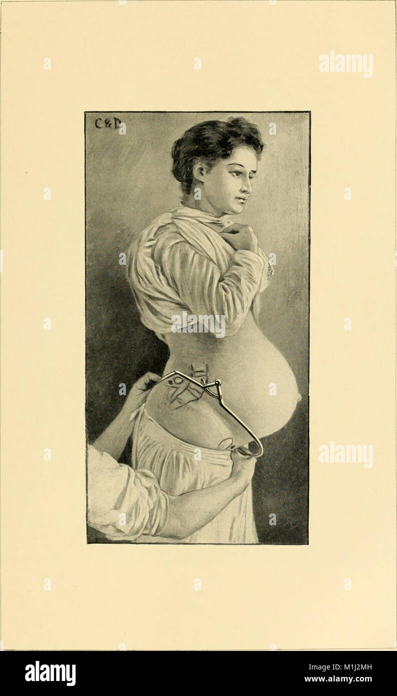 An American text-book of obstetrics. For practitioners and students (1897) (14764753051) Stock Photo