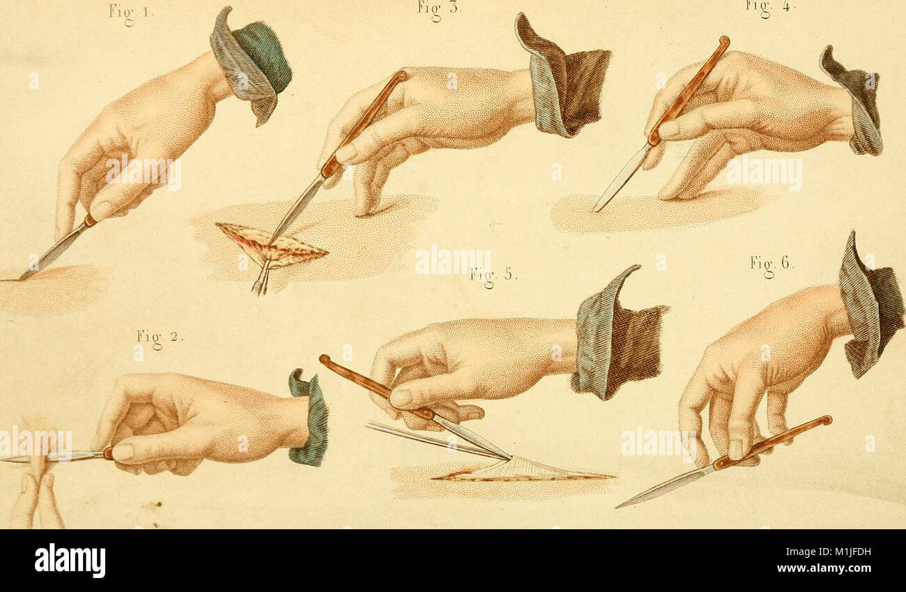 A text book of operative surgery and surgical anatomy (1878