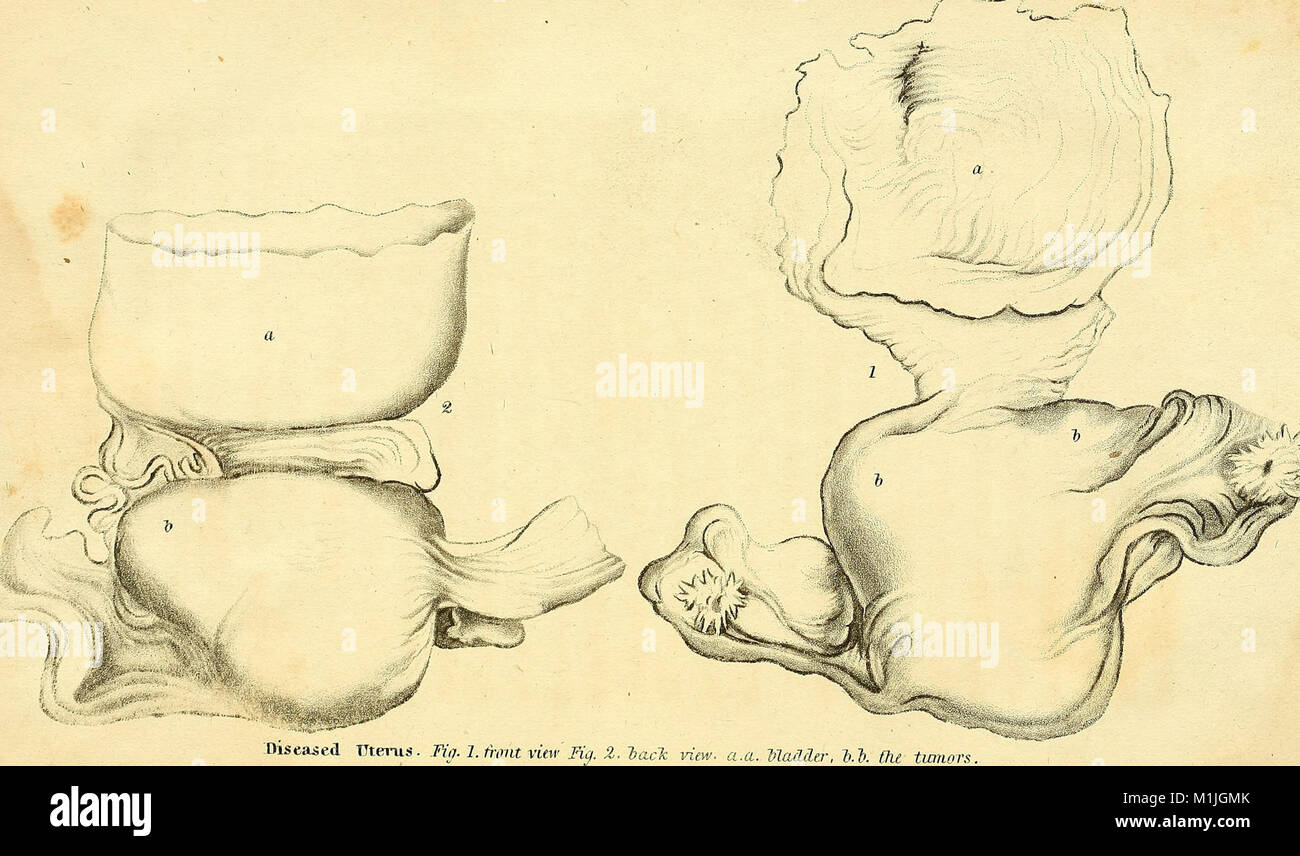 Anatomical investigations, comprising descriptions of various fasciae of the human body to which is added an account of some irregularities of structure and morbid anatomy; with a description of a new (17549108733) Stock Photo