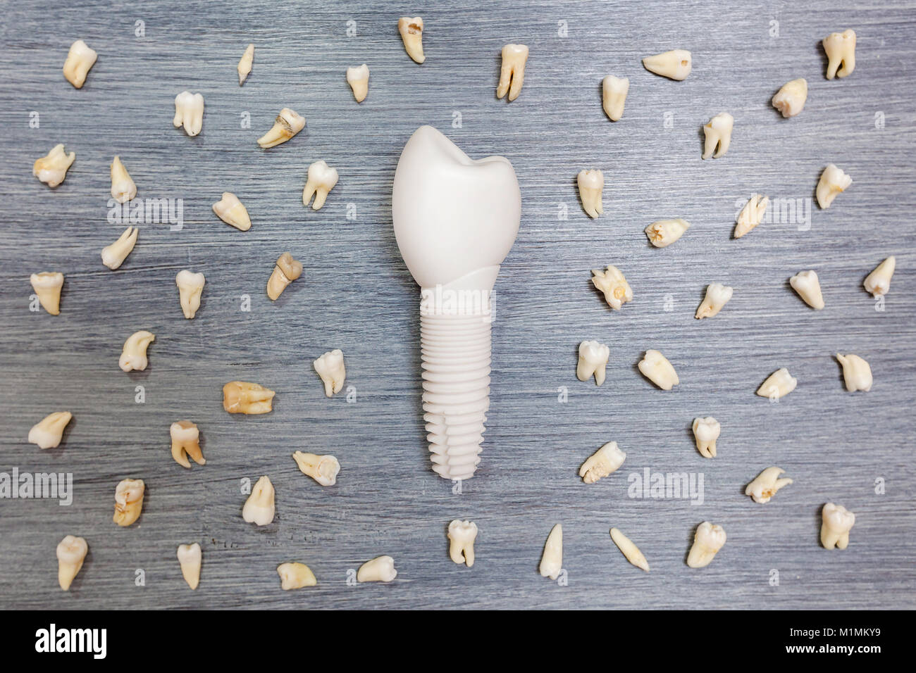 Broken teeth are on the table. Model of dental implant Teeth of people