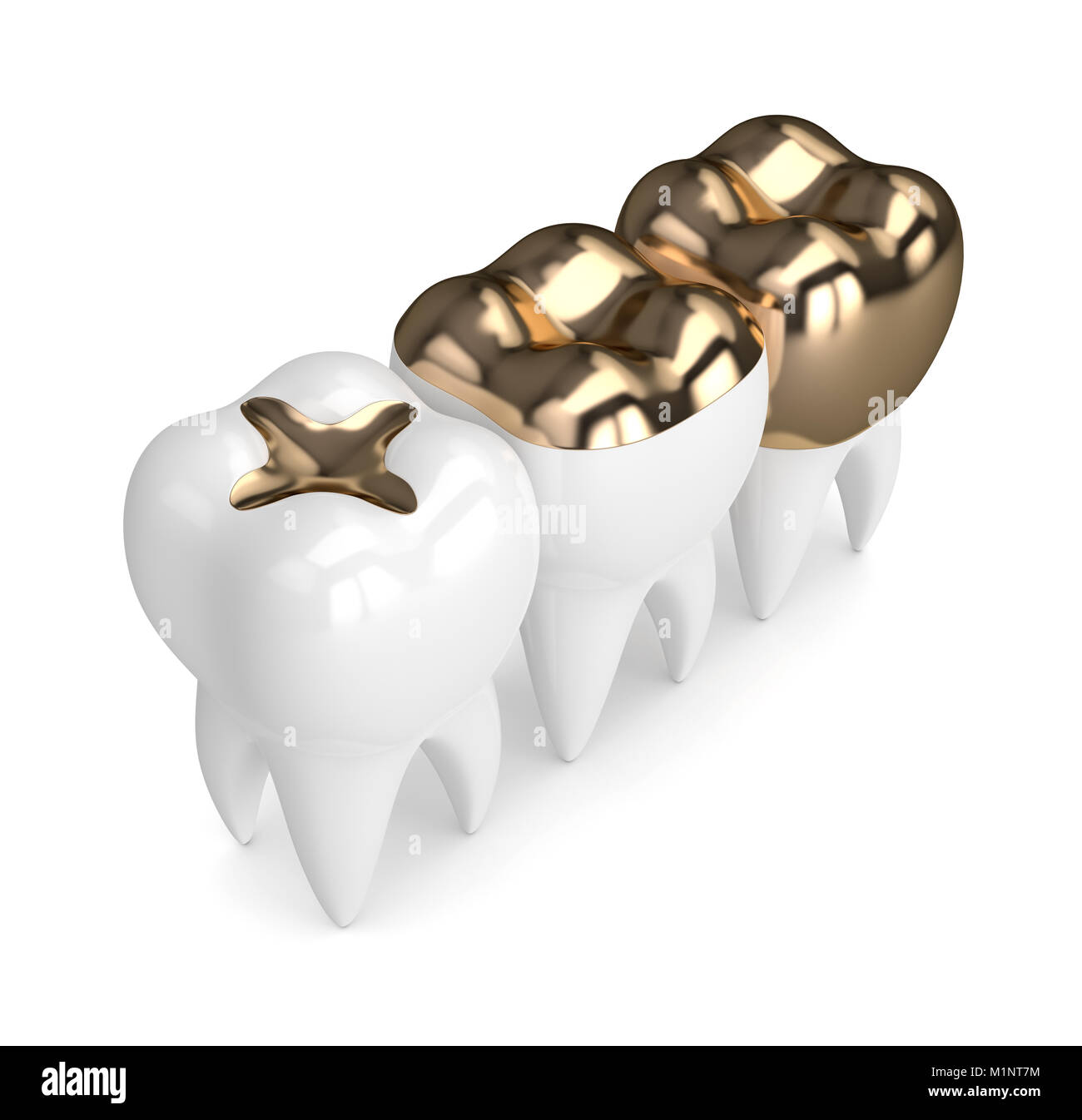 Gold filling teeth hires stock photography and images Alamy