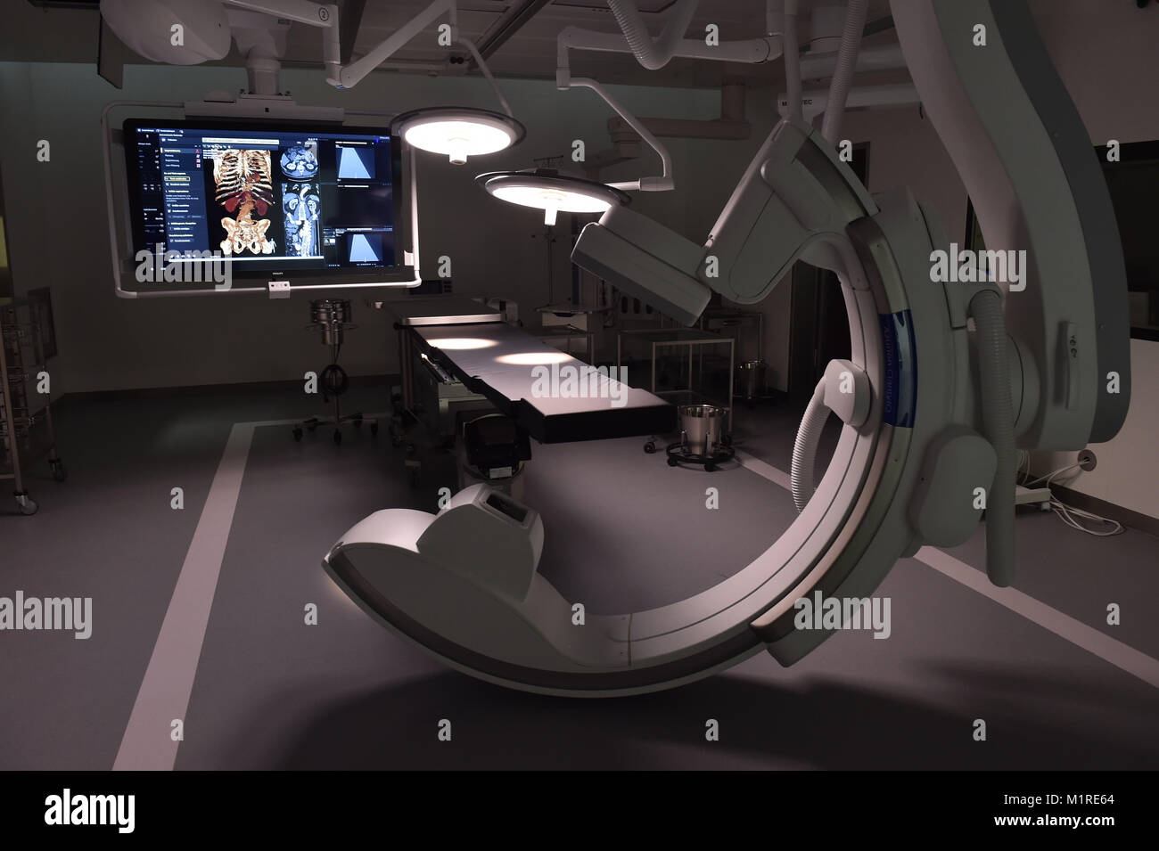 An interior view of a new surgery room equipped with an angiographic C-arm system during the inaugural press conference at the clinic right of the river Isar in Munich, 1 February 2018. It is able to generate images from body parts similar to those of a CT scan. Neurosurgeons, vascular surgeons and urologists are going to have eight new surgery rooms to work in. Photo: Lino Mirgeler/dpa Stock Photo