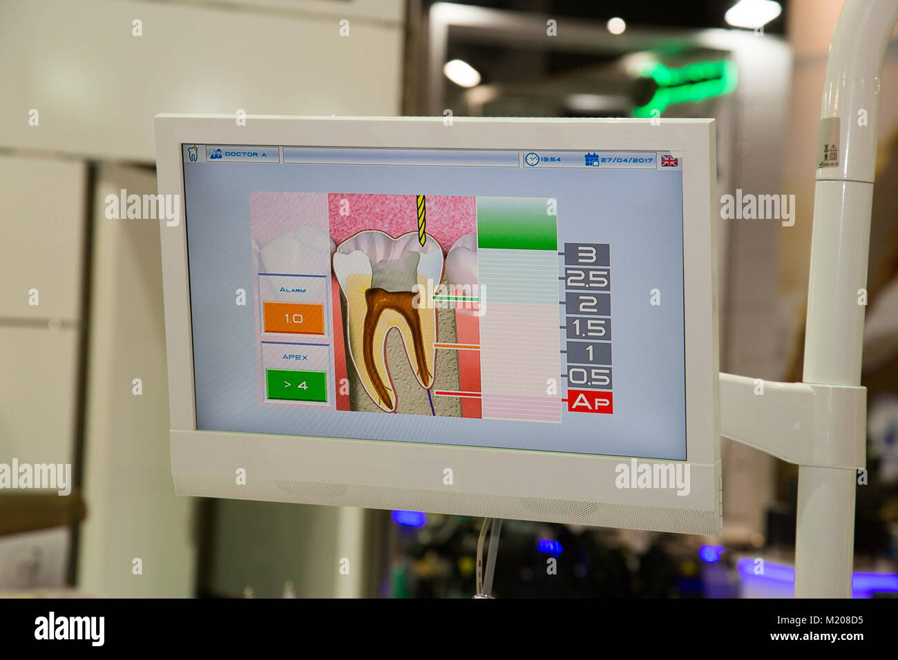 Rotting teeth view from dentist screen Stock Photo - Alamy