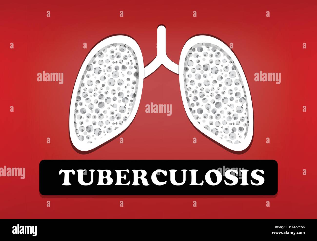 tuberculosis-health-and-disease