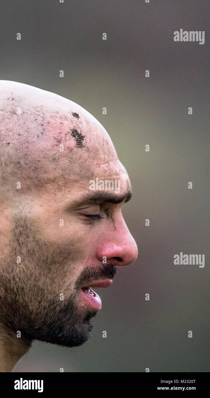 Head injury on a amateur rugby union player. Stock Photo