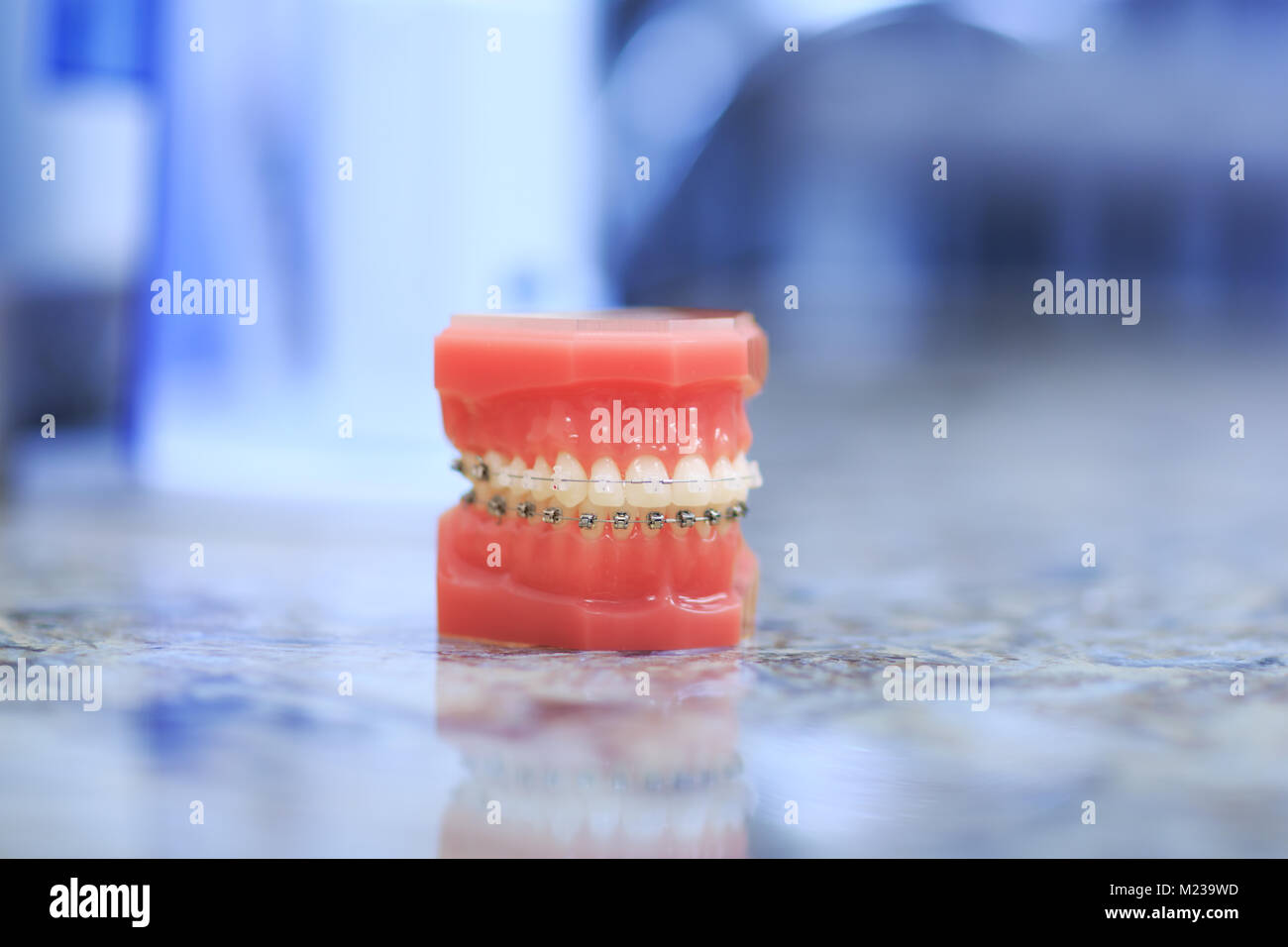 Tooth model with metal wired dental braces. Teeth orthodontic dental