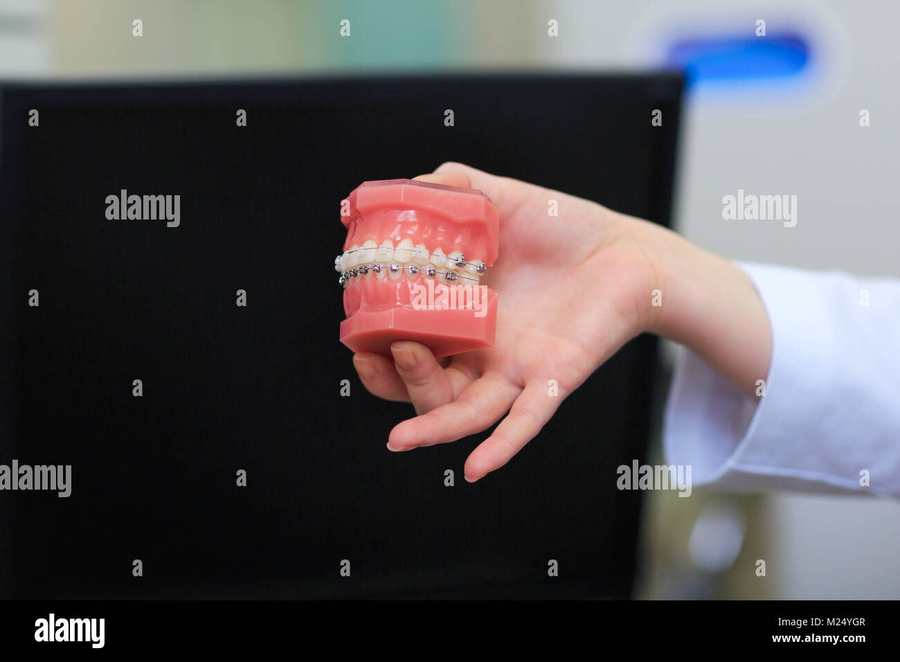 Dentist holding tooth model with metal wired dental braces. Teeth