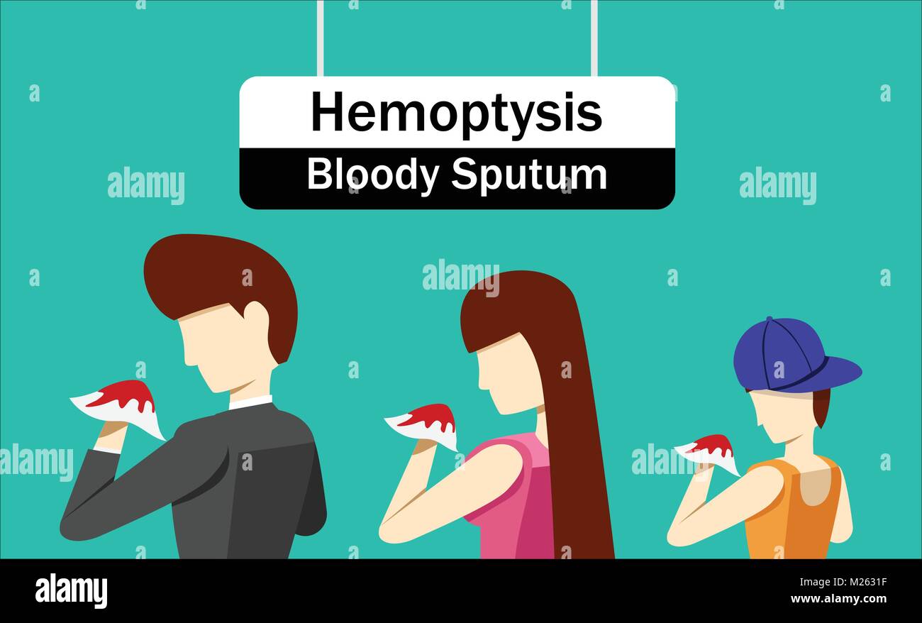 Hemoptysis or Bloody Sputum in Vector art design Stock Vector