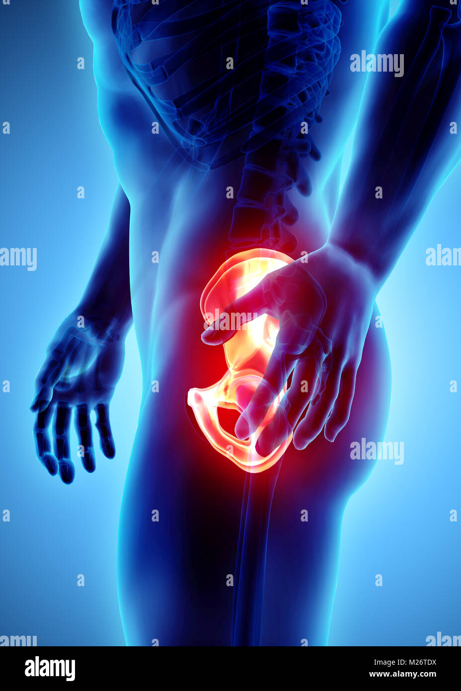 3D illustration, hip painful skeleton x-ray, medical concept Stock ...