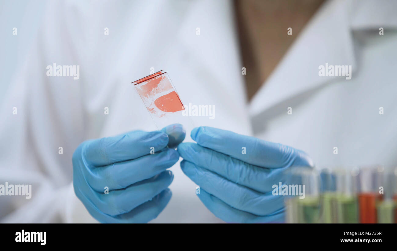 Microbiological specimens hi-res stock photography and images - Alamy