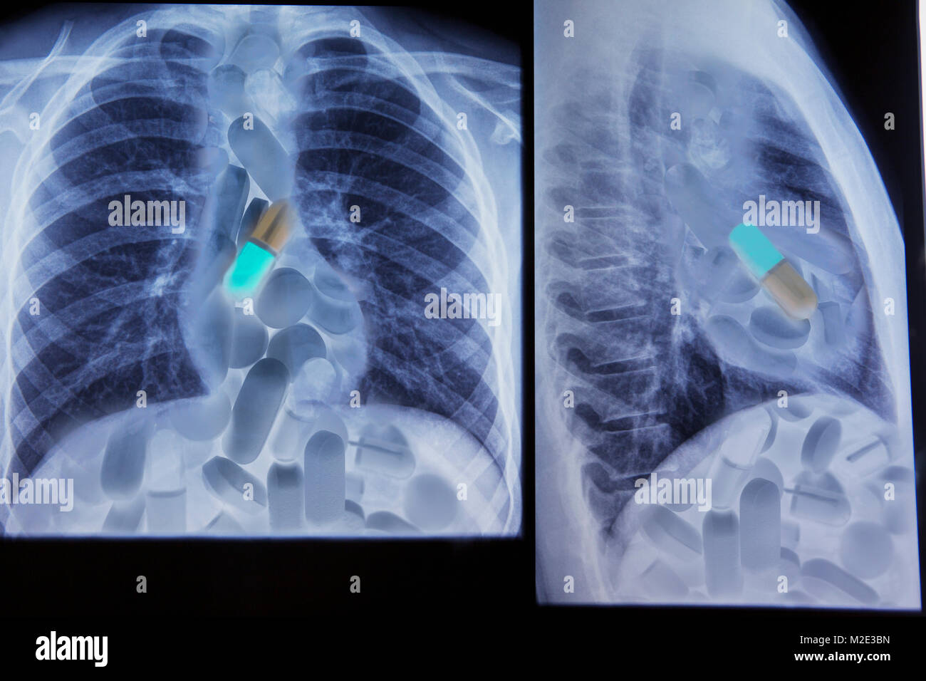 Close up of xrays of pharmaceutical pills in chest Stock Photo Alamy