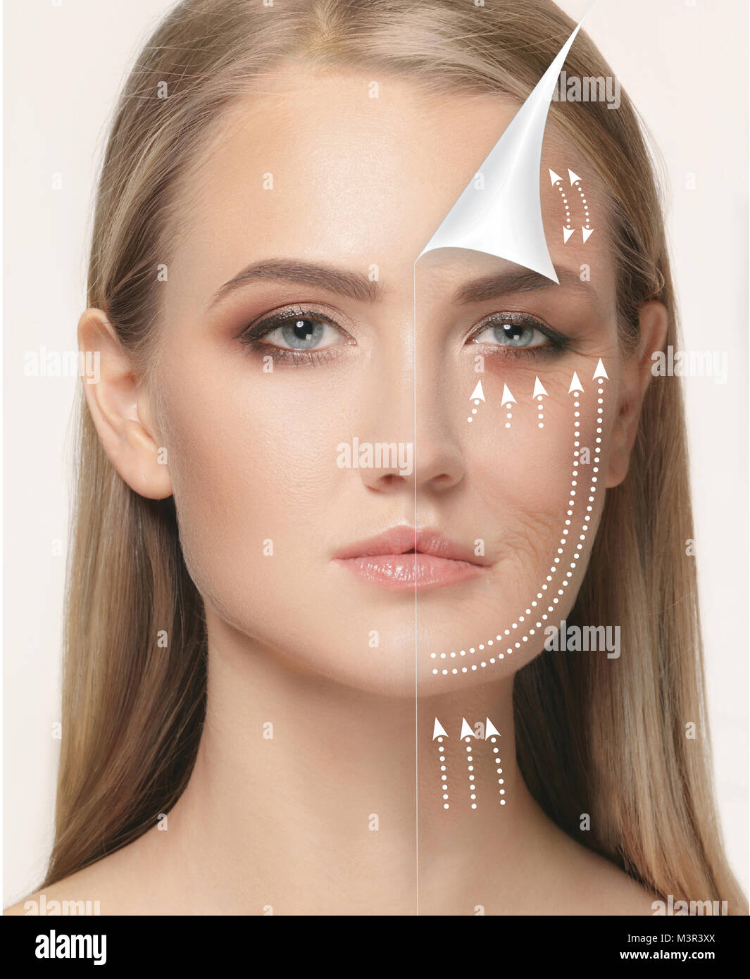 The young female face. Antiaging and thread lifting concept Stock Photo ...