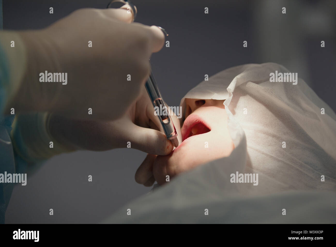 Doctor dentist performs a procedure anesthesia before stomatology