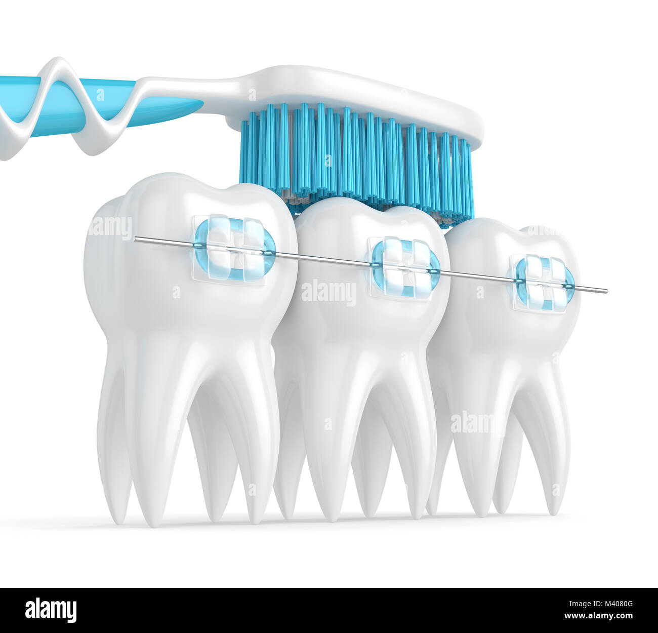 3d render of teeth with ceramic braces and toothbrush isolated over ...