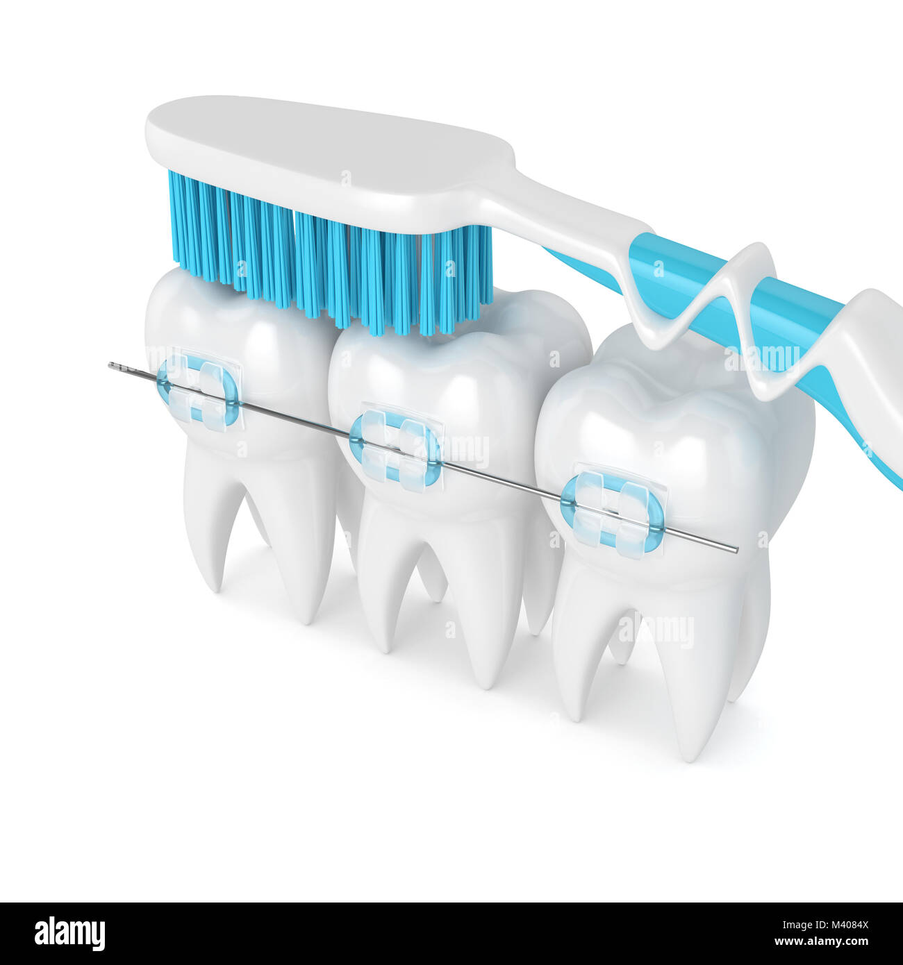 3d render of teeth with ceramic braces and toothbrush isolated over ...
