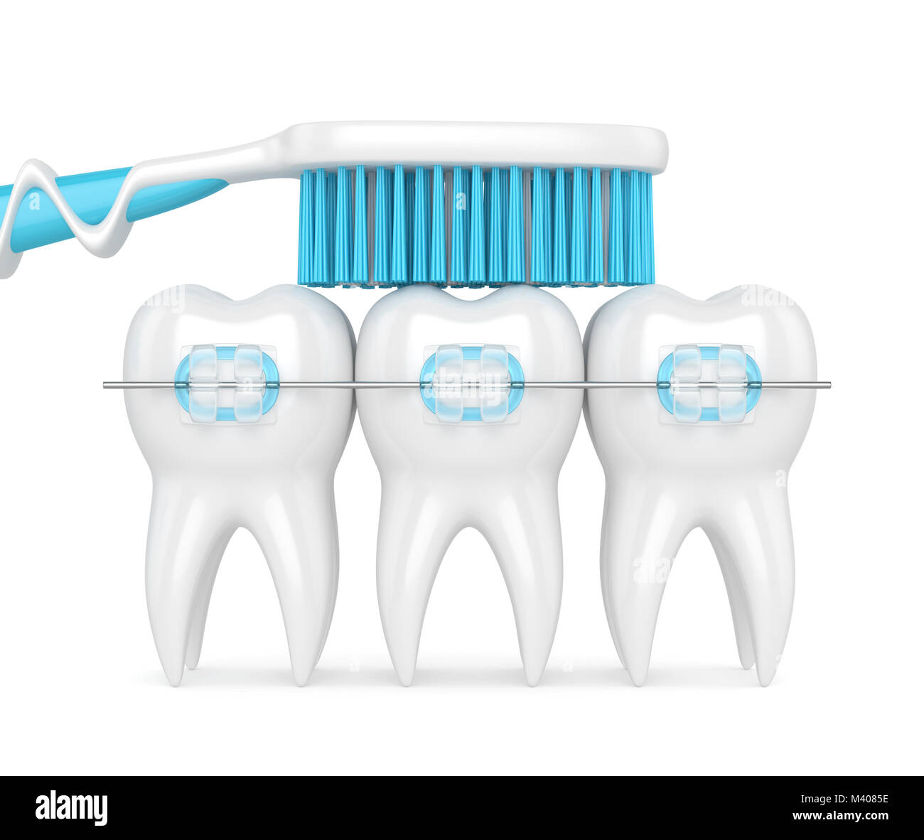 3d render of teeth with ceramic braces and toothbrush isolated over ...