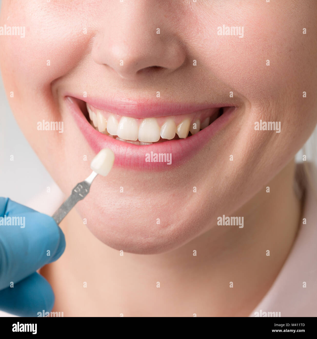 Close up of dentist using shade guide at woman's mouth to check veneer