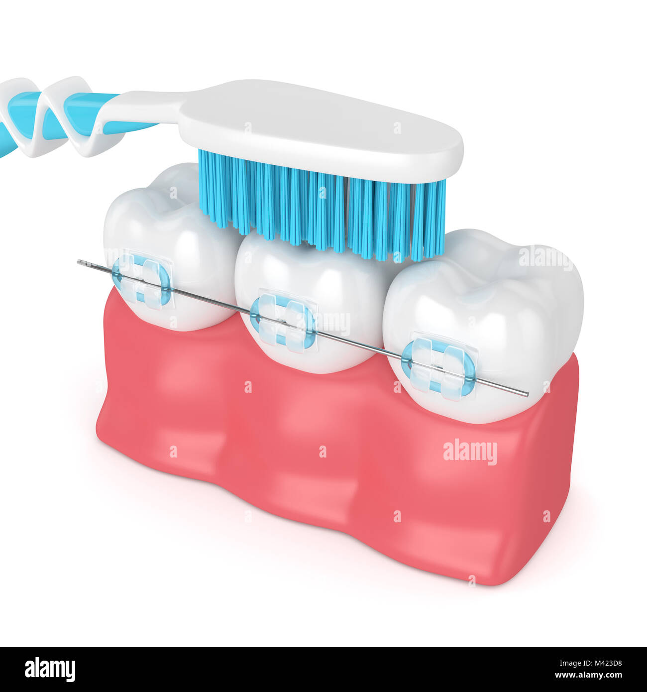 3d render of teeth with ceramic braces and toothbrush isolated over ...
