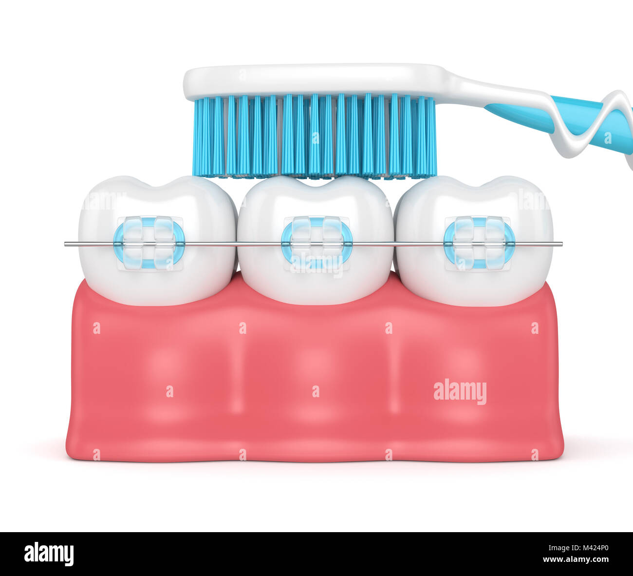3d render of teeth with ceramic braces and toothbrush isolated over ...