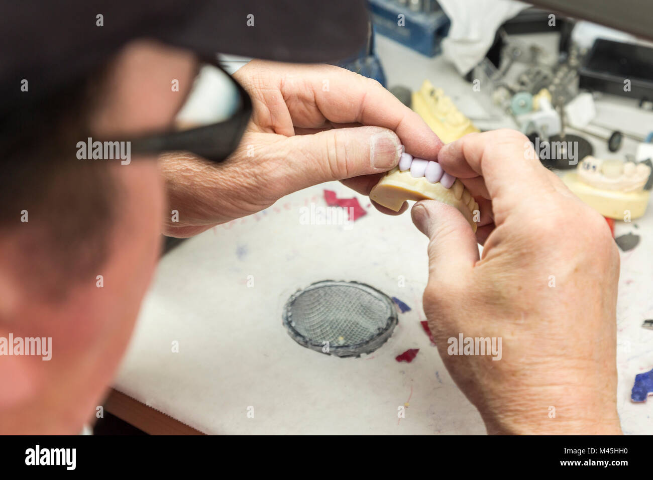 Male Dental Technician Working On A 3D Printed Mold For Tooth Implants