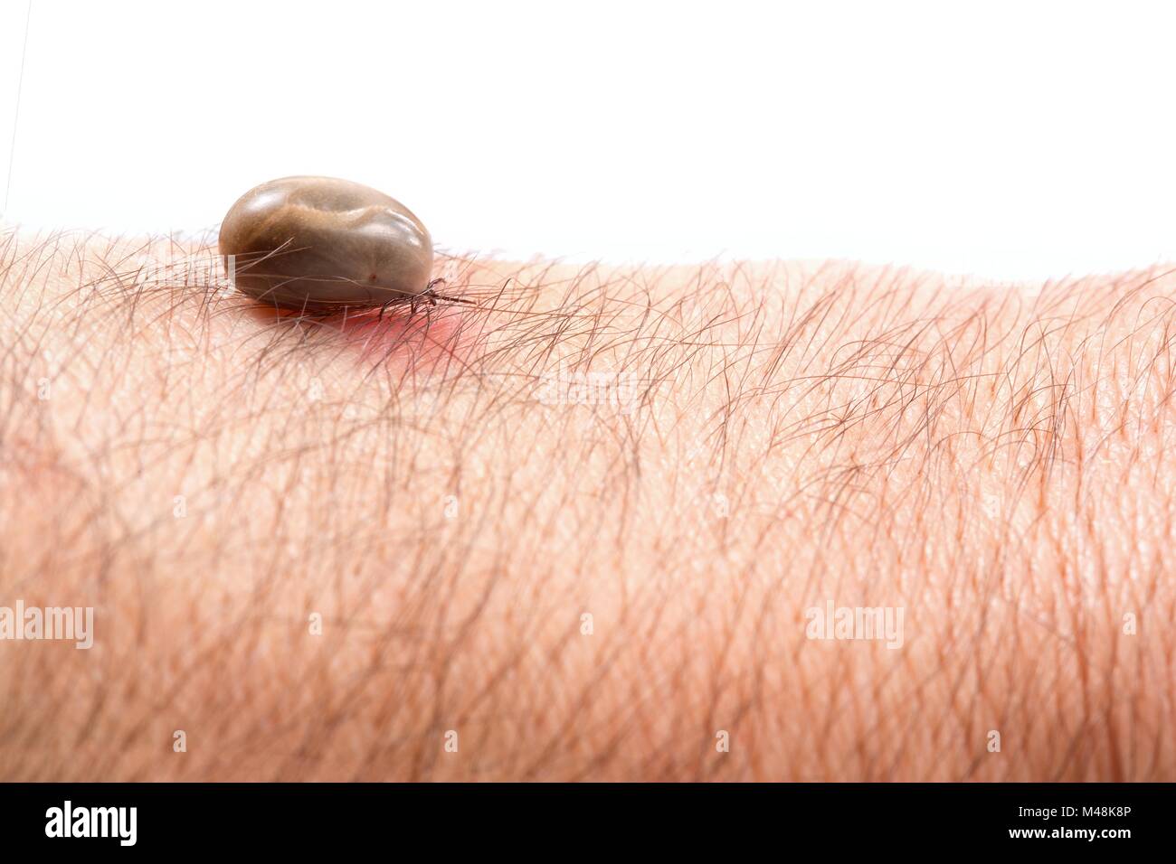Detail tick - parasite on leather of man (Rhipicephalus sanguineus) Stock Photo